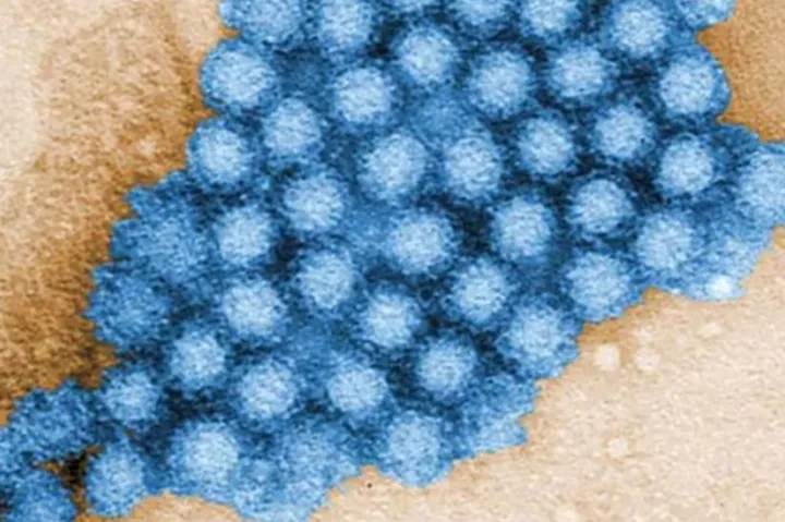 افزایش موارد نوروویروس: چالش جدید فصل سرما